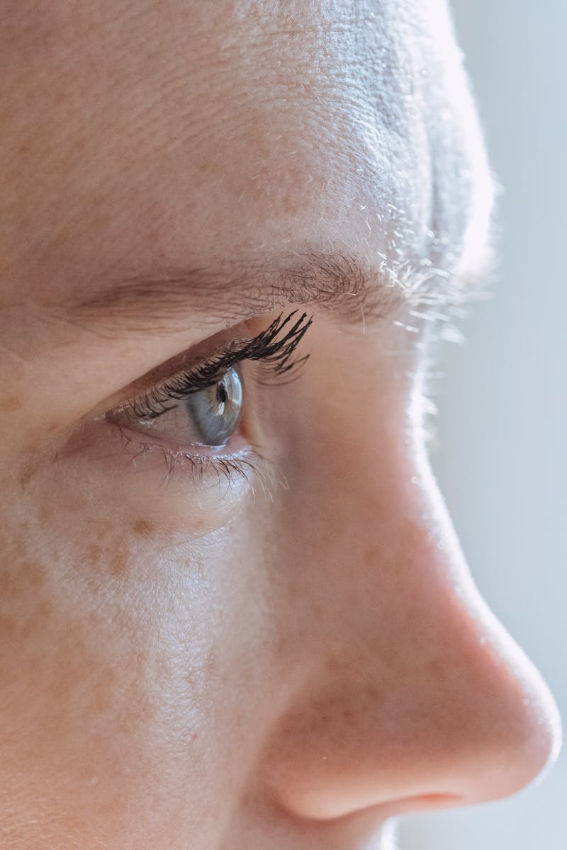 Priebeh operácie očných viečok: Krok za krokom